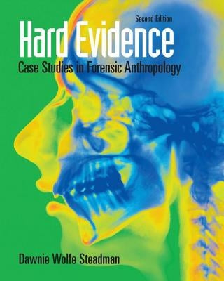 Hard Evidence: Case Studies in Forensic Anthropology Paperback Routledge