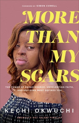 More Than My Scars: The Power of Perseverance, Unrelenting Faith, and Deciding What Defines You Paperback Baker Books